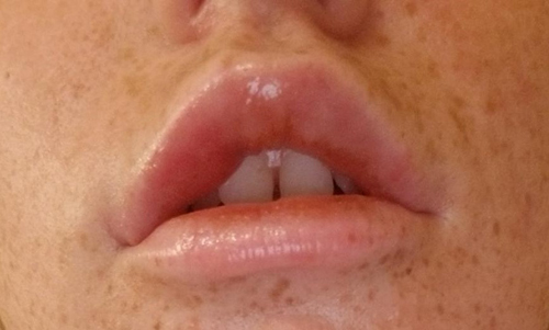 Lip gone bad - Front